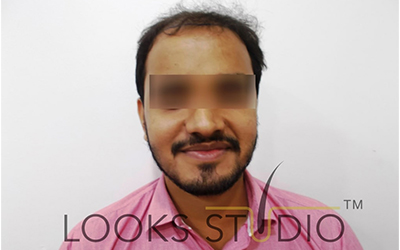 After Image